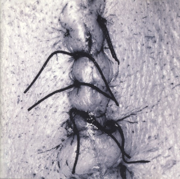 Infliction