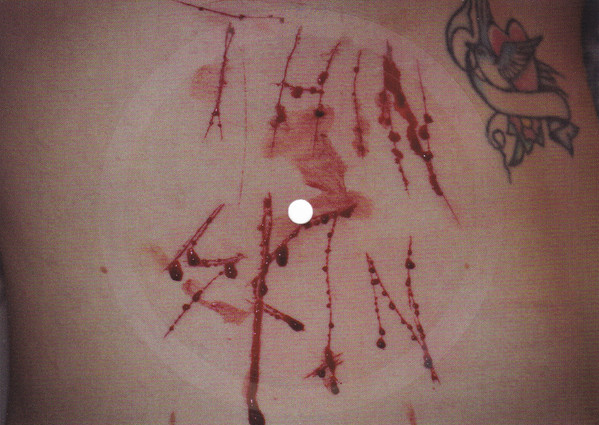 Thin Skin