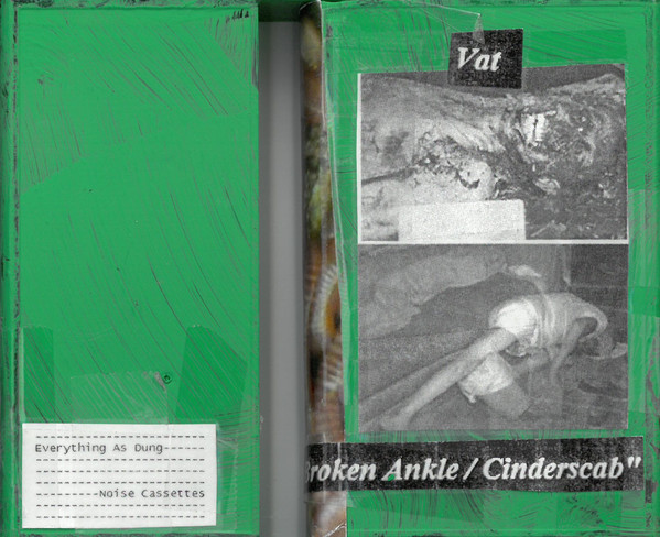 9 Y/o Broken Ankle / Cinderscab