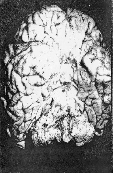 Laughing Venus / Bog Of Dead Flies