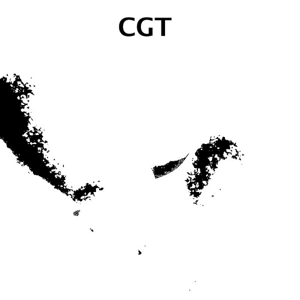 CGT