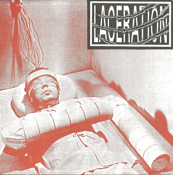 Laceration / East Coast Super Stars