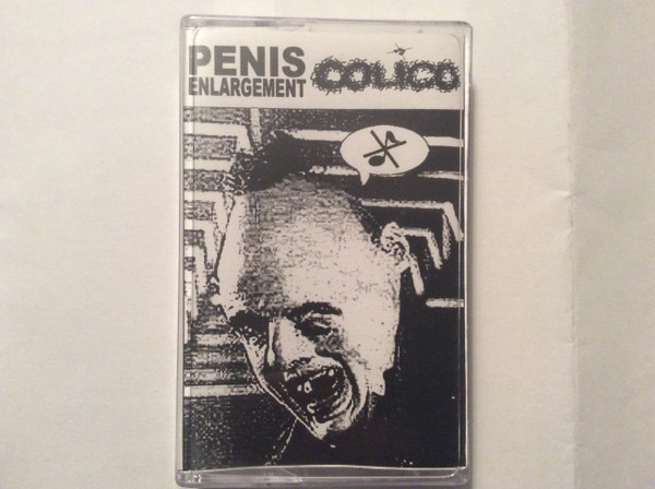 Split Tape 08