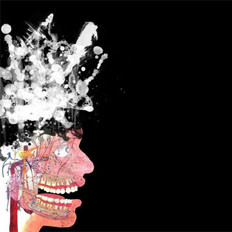 Headache