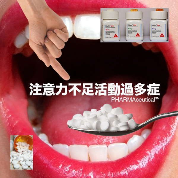 注意力不足活動過多症