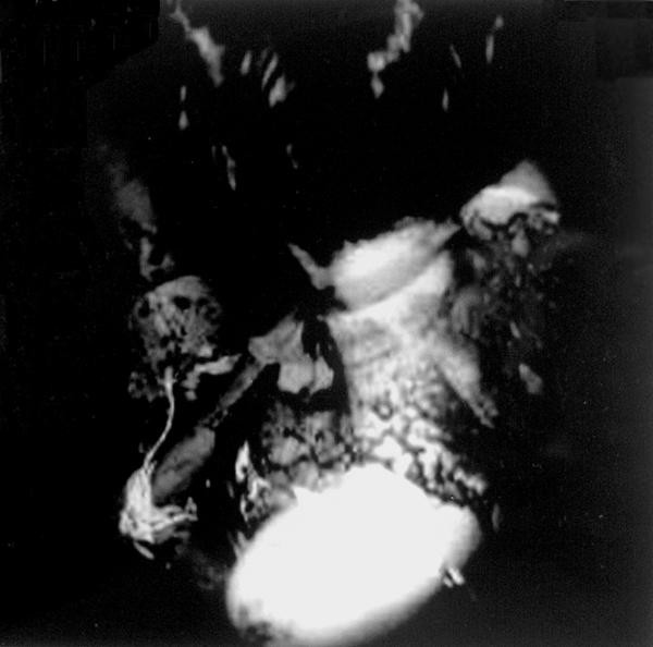 Bathed In Brain, Blood, And Bone