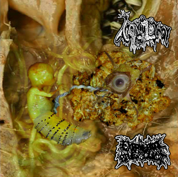 Vomitoma / Extrahepatic Bile Duct