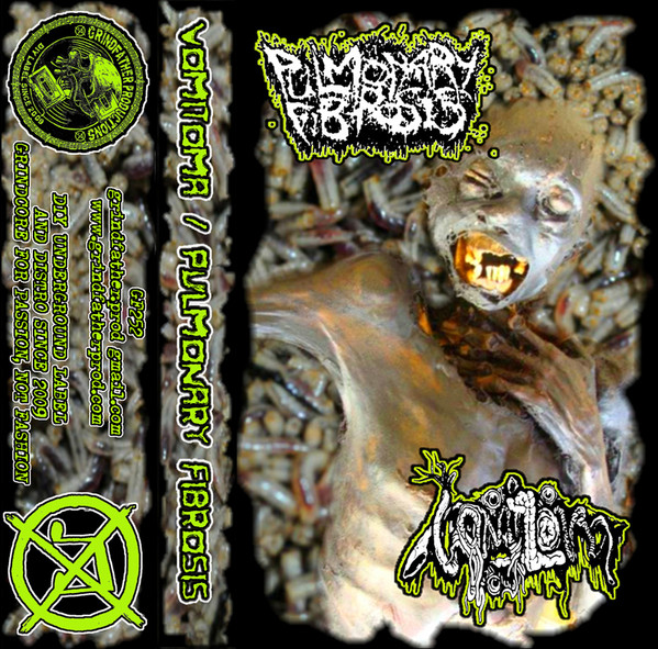 Vomitoma / Pulmonary Fibrosis