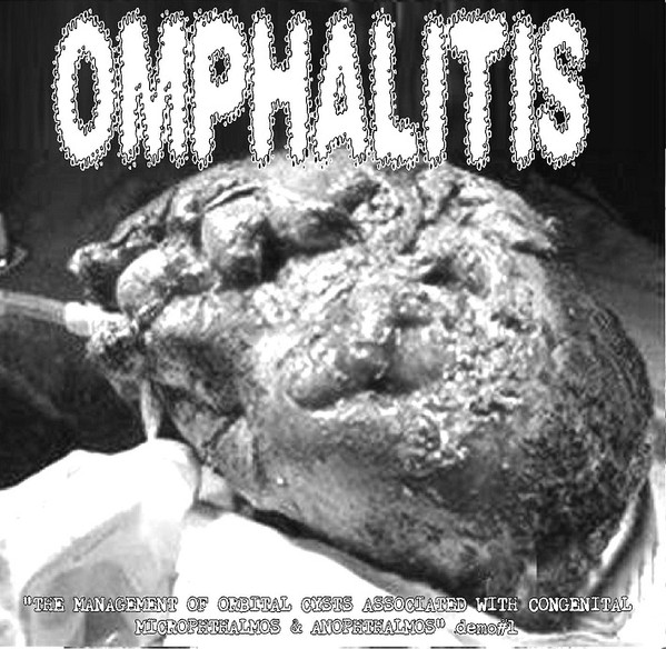 The Management Of Orbital Cysts Associated With Congenital Microphthalmos And Anophthalmos - Demo #1