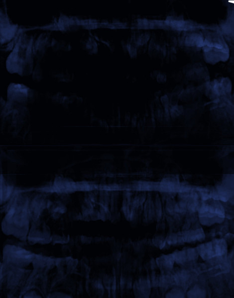 Cutting Teeth
